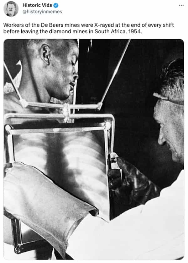 Workers of the De Beers mines were X-rayed at the end of every shift before leaving the diamond mines in South Africa. 1954.