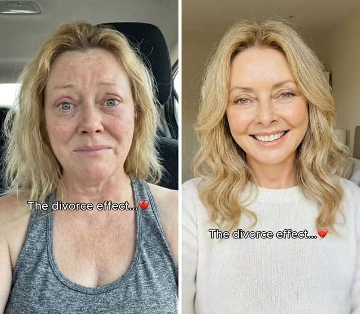 Woman before and after divorce comparison showing glowing skin transformation.