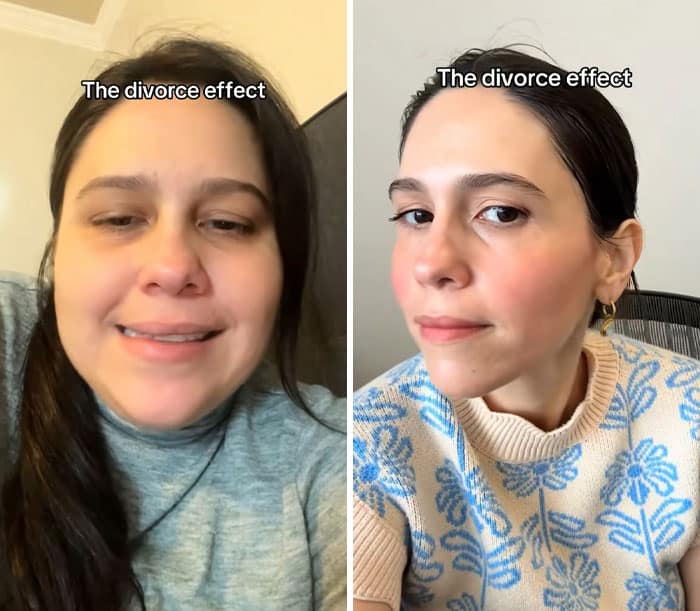 Comparison of puffy stressed face versus defined glowing features after divorce.